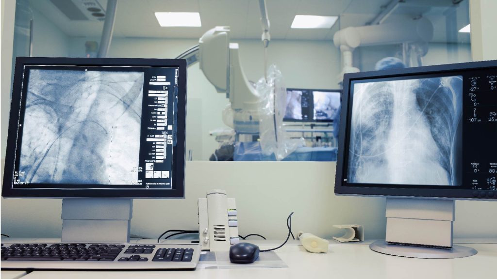 RADIATION RESISTANT GLASS
